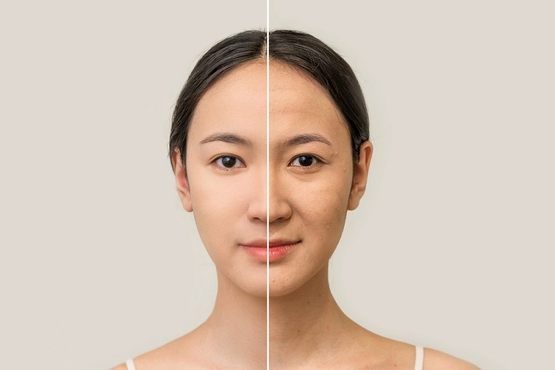 khi nào nên nâng cơ mặt?