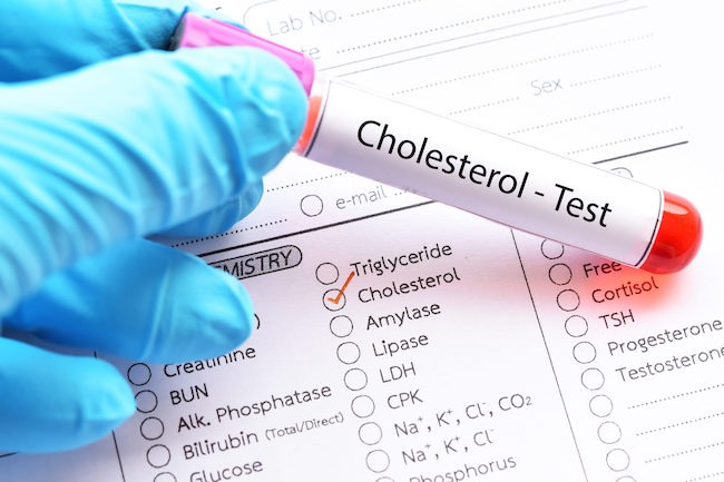 Xét nghiệm Cholesterol