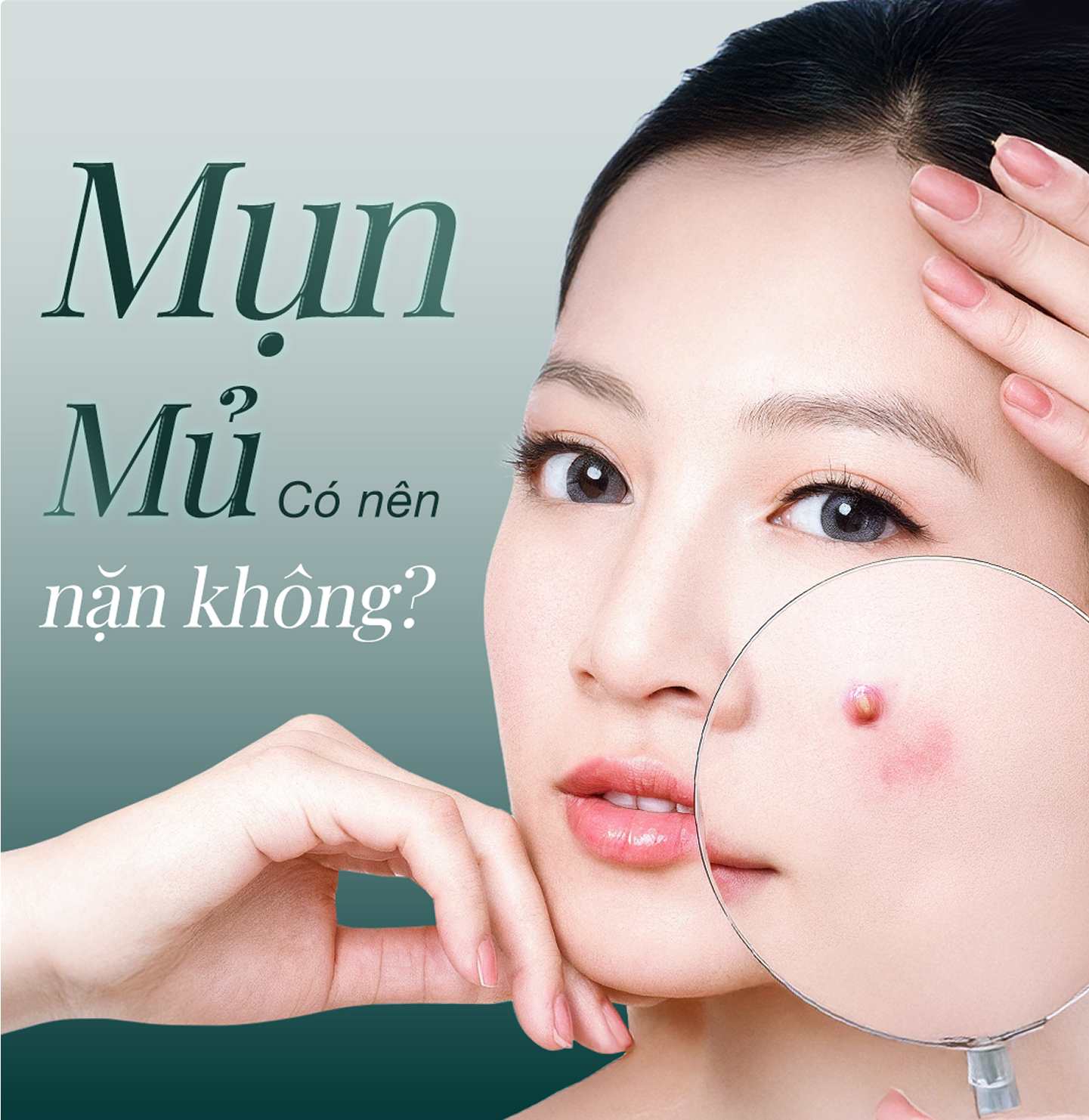 TOP 20 Cách Hết Mụn Nhanh Nhất Tại Nhà Và Cực Hiệu Quả